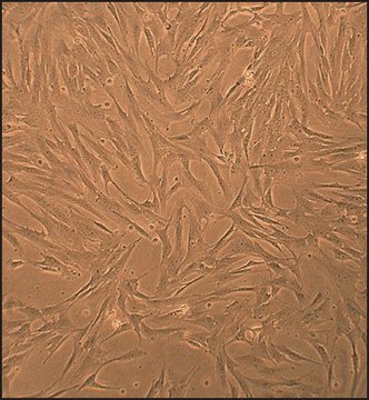 Porcine Pulmonary Artery Smooth Muscle Cells: PPASMC (Cryovial)