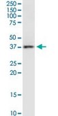 Monoclonal Anti-RAMP3 antibody produced in mouse clone 1C11, purified immunoglobulin, buffered aqueous solution