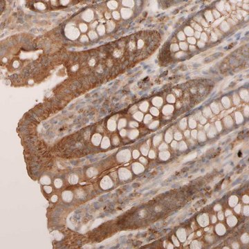 Anti-VSTM2A antibody produced in rabbit Prestige Antibodies&#174; Powered by Atlas Antibodies, affinity isolated antibody, buffered aqueous glycerol solution, Ab2