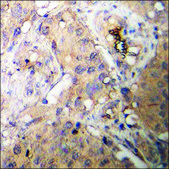 Anti-phospho-Akt (pThr308) antibody produced in rabbit affinity isolated antibody