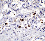 Anti-SARS-CoV-2 (COVID-19) Spike antibody produced in rabbit affinity isolated antibody