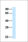 Anti-RORA (ab2) antibody produced in rabbit affinity isolated antibody