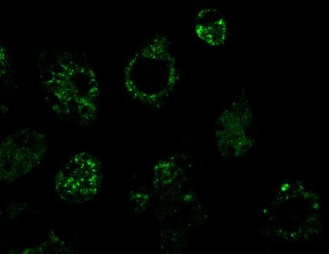 BioTracker CDg16 Activated Macrophage Probe