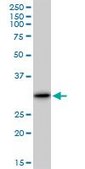 Anti-LGALS3 antibody produced in mouse purified immunoglobulin, buffered aqueous solution