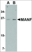 Anti-MANF antibody produced in rabbit affinity isolated antibody, buffered aqueous solution