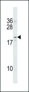 ANTI-NKAIN2 (CENTER) antibody produced in rabbit IgG fraction of antiserum, buffered aqueous solution