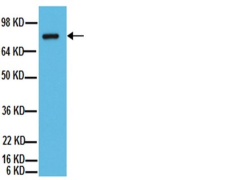 Anti-ADAM 10 Antibody, CT Chemicon&#174;, from rabbit