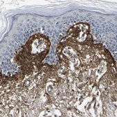 Anti-POSTN antibody produced in rabbit Prestige Antibodies&#174; Powered by Atlas Antibodies, affinity isolated antibody, buffered aqueous glycerol solution