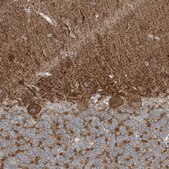 Anti-SLC4A10 antibody produced in rabbit Prestige Antibodies&#174; Powered by Atlas Antibodies, affinity isolated antibody, buffered aqueous glycerol solution