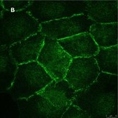 Anti-beta Catenin Antibody, clone 3J7, ZooMAb&#174; Rabbit Monoclonal recombinant, expressed in HEK 293 cells