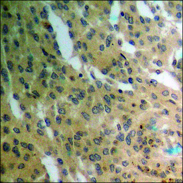 Anti-phospho-PTEN (pSer385) antibody produced in rabbit affinity isolated antibody
