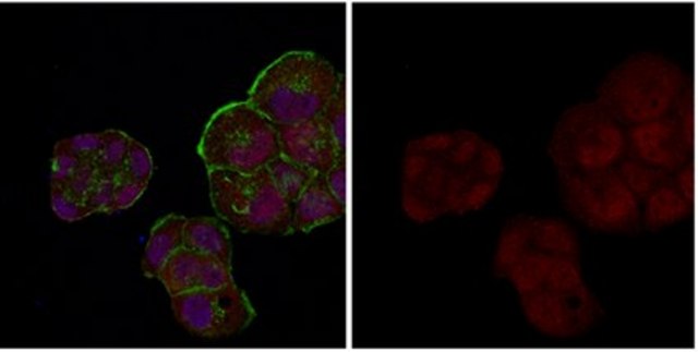 Anti-Androgen Receptor Antibody, Alexa Fluor&#8482; 555 Conjugate from rabbit, ALEXA FLUOR&#8482; 555