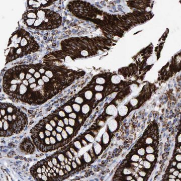 Anti-MRPL12 antibody produced in rabbit Prestige Antibodies&#174; Powered by Atlas Antibodies, affinity isolated antibody, buffered aqueous glycerol solution, Ab2