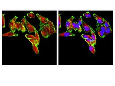 Anti-PI3 Kinase Antibody, p110&#946; from rabbit, purified by affinity chromatography