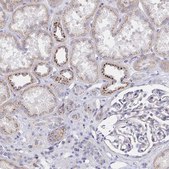 Anti-MAN1A1 antibody produced in rabbit Prestige Antibodies&#174; Powered by Atlas Antibodies, affinity isolated antibody, buffered aqueous glycerol solution