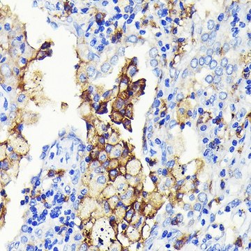 Anti-CD14 antibody produced in rabbit