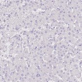 Anti-ACR antibody produced in rabbit Prestige Antibodies&#174; Powered by Atlas Antibodies, affinity isolated antibody, buffered aqueous glycerol solution