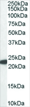 Anti-Glutathione peroxidase 1 (ISO1) antibody produced in goat affinity isolated antibody, buffered aqueous solution