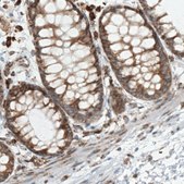 Monoclonal Anti-MTDH antibody produced in mouse Prestige Antibodies&#174; Powered by Atlas Antibodies, clone CL0401, purified immunoglobulin, buffered aqueous glycerol solution