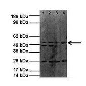 Anti-PAX3 antibody produced in rabbit affinity isolated antibody