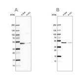 Anti-EPHX1 antibody produced in rabbit Prestige Antibodies&#174; Powered by Atlas Antibodies, affinity isolated antibody, buffered aqueous glycerol solution
