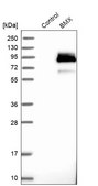 Anti-BMX antibody produced in rabbit Prestige Antibodies&#174; Powered by Atlas Antibodies, affinity isolated antibody, buffered aqueous glycerol solution