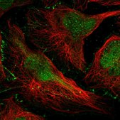 Anti-DONSON antibody produced in rabbit Prestige Antibodies&#174; Powered by Atlas Antibodies, affinity isolated antibody, buffered aqueous glycerol solution