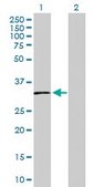 Anti-SLC14A1 antibody produced in rabbit purified immunoglobulin, buffered aqueous solution