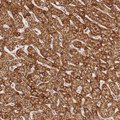 Anti-SDHB antibody produced in rabbit Prestige Antibodies&#174; Powered by Atlas Antibodies, affinity isolated antibody, buffered aqueous glycerol solution