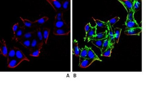 Anti-beta Arrestin 1 Antibody, clone 3H11.2 clone 3H11.2, from mouse