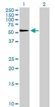Anti-SERPINF1 antibody produced in rabbit purified immunoglobulin, buffered aqueous solution