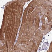 Anti-CFL2 antibody produced in rabbit Prestige Antibodies&#174; Powered by Atlas Antibodies, affinity isolated antibody, buffered aqueous glycerol solution