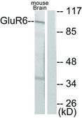 Anti-MGLUR6 antibody produced in rabbit affinity isolated antibody