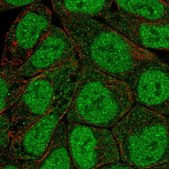 Anti-PRKCB antibody produced in rabbit Prestige Antibodies&#174; Powered by Atlas Antibodies, affinity isolated antibody, buffered aqueous glycerol solution