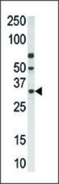 Anti-PPT2 (N-term) antibody produced in rabbit IgG fraction of antiserum, buffered aqueous solution