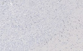 Anti-Tyrosine Hydroxylase Antibody, clone 2/40/15 ZooMAb&#174; Mouse Monoclonal recombinant, expressed in HEK 293 cells