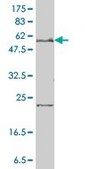 Monoclonal Anti-SLC27A4 antibody produced in mouse clone 1F4-1B10, purified immunoglobulin, buffered aqueous solution