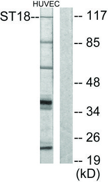 Anti-ZNF387 antibody produced in rabbit affinity isolated antibody