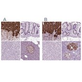 Anti-CHGB antibody produced in rabbit Prestige Antibodies&#174; Powered by Atlas Antibodies, affinity isolated antibody, buffered aqueous glycerol solution