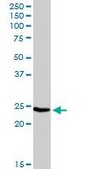 Anti-IGLL1 antibody produced in rabbit purified immunoglobulin, buffered aqueous solution