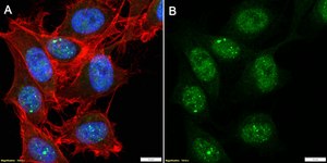 Anti-SREBF2 Antibody, clone 2K8 ZooMAb&#174; Rabbit Monoclonal recombinant, expressed in HEK 293 cells