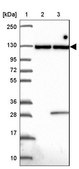 Anti-INTS8 antibody produced in rabbit Prestige Antibodies&#174; Powered by Atlas Antibodies, affinity isolated antibody, buffered aqueous glycerol solution