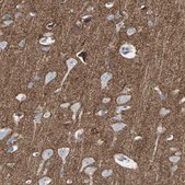 Anti-NFASC antibody produced in rabbit Prestige Antibodies&#174; Powered by Atlas Antibodies, affinity isolated antibody, buffered aqueous glycerol solution