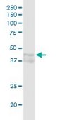 Anti-CCNE1 antibody produced in rabbit IgG fraction of antiserum, buffered aqueous solution