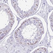 Anti-PPP1R17 antibody produced in rabbit Prestige Antibodies&#174; Powered by Atlas Antibodies, affinity isolated antibody, buffered aqueous glycerol solution
