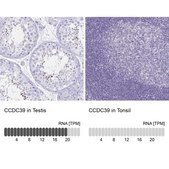 Anti-CCDC39 antibody produced in rabbit Prestige Antibodies&#174; Powered by Atlas Antibodies, affinity isolated antibody, buffered aqueous glycerol solution
