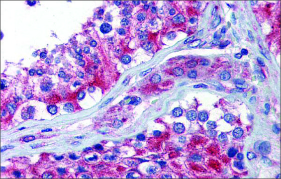 Anti-NPY1R antibody produced in rabbit affinity isolated antibody