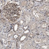 Anti-UTRN antibody produced in rabbit Prestige Antibodies&#174; Powered by Atlas Antibodies, affinity isolated antibody, buffered aqueous glycerol solution