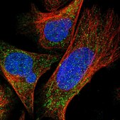 Anti-DDX28 antibody produced in rabbit Prestige Antibodies&#174; Powered by Atlas Antibodies, affinity isolated antibody, buffered aqueous glycerol solution