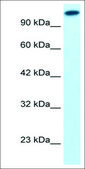 Anti-GLI2 IgG fraction of antiserum